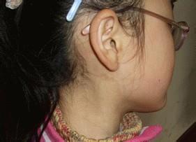 u=1930776111,77970416&fm=26&gp=0.jpg